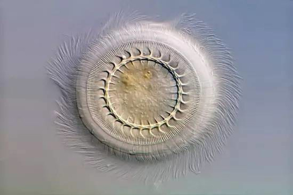 草魚(yú)寸片“白嘴白尾”、死亡嚴(yán)重？謹(jǐn)防車(chē)輪蟲(chóng)病